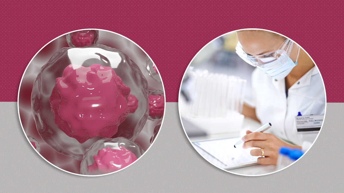 New Drug Trial Shows 100% Success Rate In Patients Of Rectal Cancer